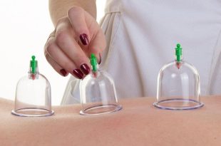 Hacamat Uygulaması Etkileri